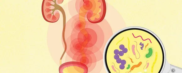 Urinary Tract Infections : यूटीआई होने पर आपको 5 भोजन से बचना चाहिए