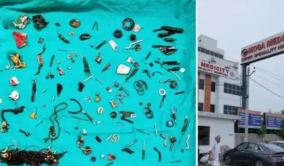 पंजाब में एक आदमी के पेट से निकाली गईं 60 से ज्यादा वस्तुएं