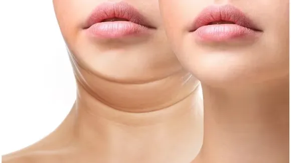 Double Chin: कैसे ख़त्म करें चेहरे पर बढ़ती डबल चिन को