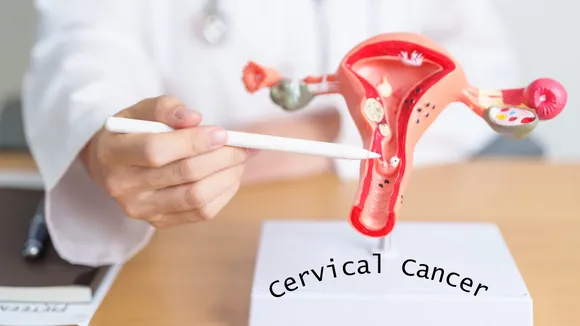 Five Important Symptoms of Cervical Cancer are Discussed