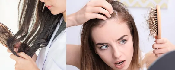 Foods For Hair : ये फूड आपके बालों को बना रहे हैं कमजोर