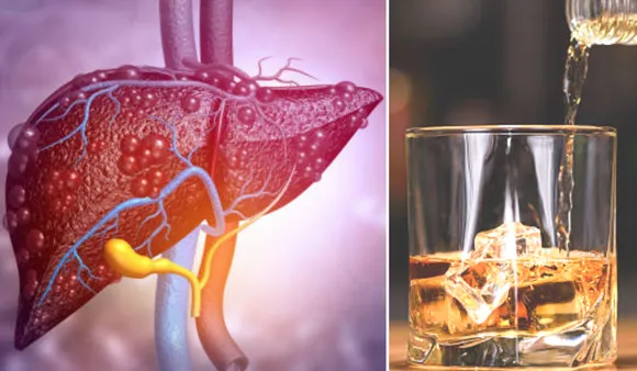 Worse For Liver: ऐसे खाद्य पदार्थ जो लीवर के लिए शराब से भी बदतर हैं