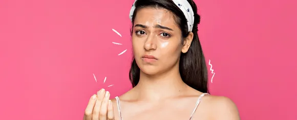 Oily Skin : जानें ऑयली स्किन के लिए 5 बेस्ट इनग्रेडिएंट्स