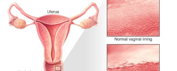 Vagina और Vulva में क्या अंतर है, जानें एक्सपर्ट्स से