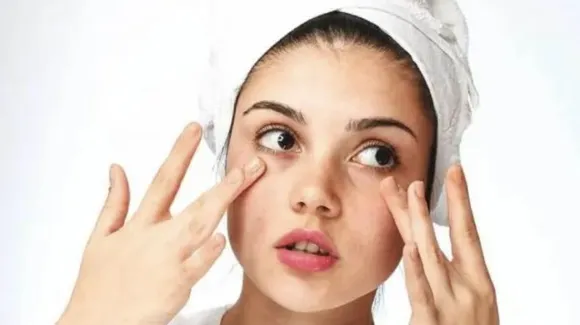 Causes of Oily Skin: ऑयली स्किन के कारण और निजात के टिप्स 