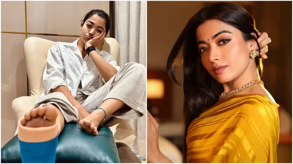 rashmika mandana leg injury updates