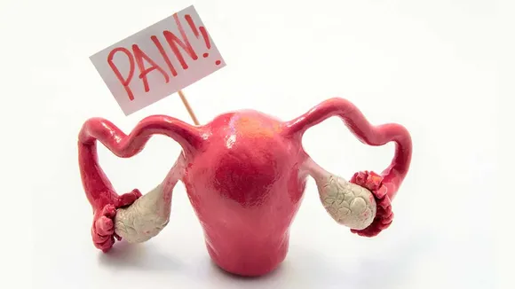pcos and exercise