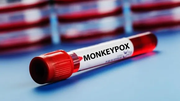 Monkeypox, monkeypox suspect, monkeypox patient, Bengaluru monkeypox, Karnataka monkeypox, monkeypox cases, Bengaluru news, Bengaluru latest