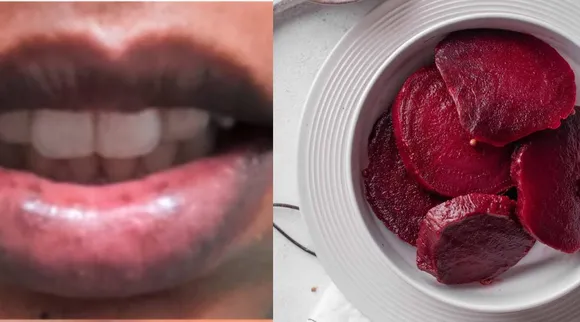 Lip pigmentation