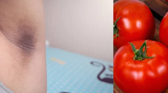 Underarm darkness removal