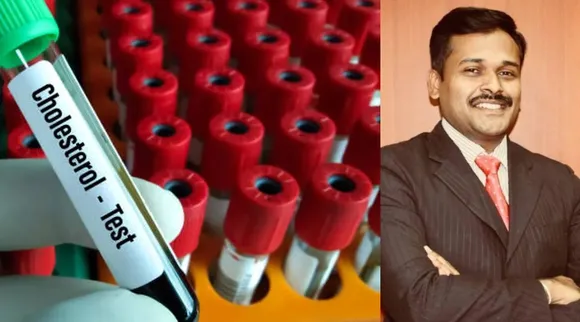 cholesterol Test