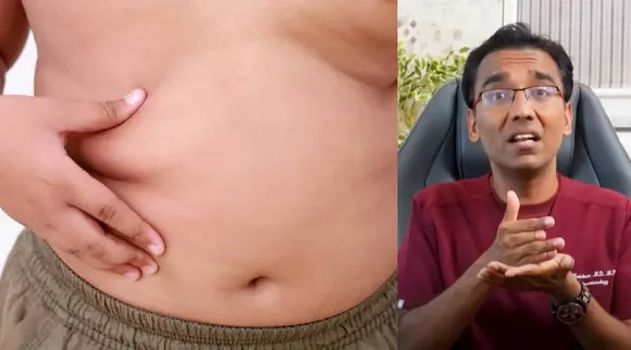 Obesity