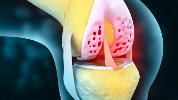 joint pain