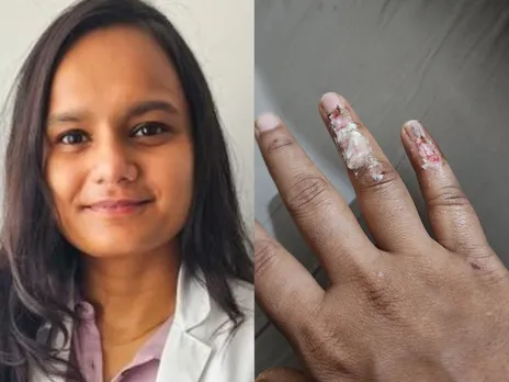 Delhi dentist says she is 'boycotting Uber' after an accident, says 'It's unsafe to travel with them'