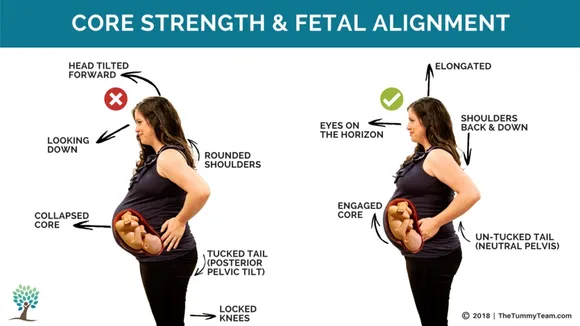 The Crucial Balance: Maintaining Proper Posture During Pregnancy
