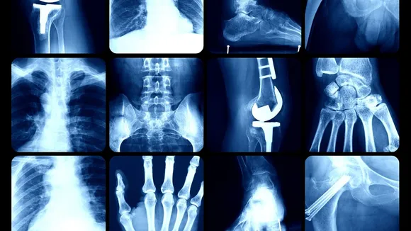 Cracking the Code: The Surprising Science Behind Why Our Joints Pop