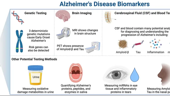 Revolutionizing Alzheimer's Diagnosis: The Rising Role of Blood Biomarkers