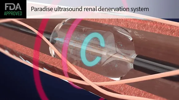 A New Era in Hypertension Treatment: FDA Approves Groundbreaking Renal Denervation Devices