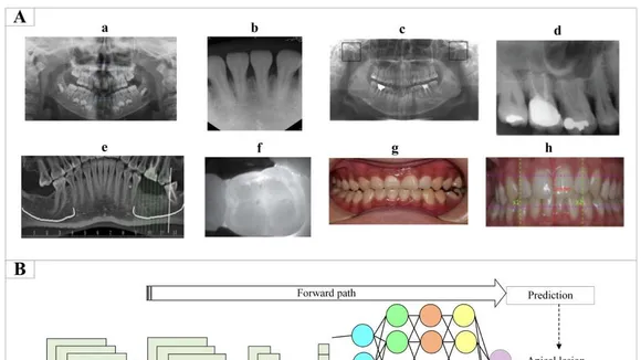 Revolutionizing Dental Diagnostics: A New Deep Learning Framework for Jaw Bone Pathologies