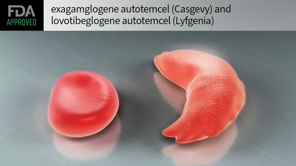 A New Era in Sickle Cell Disease Treatment: Unpacking the Success of Gene Therapy Lyfgenia