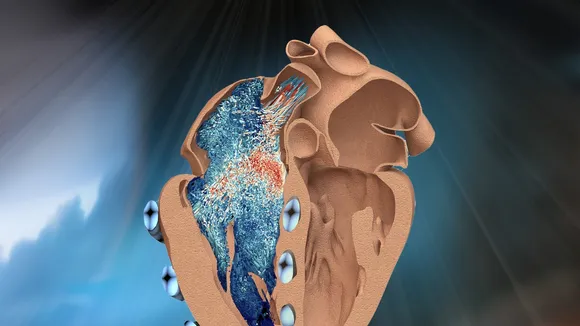 Revolution in Cardiology: MIT Engineers Develop Robotic Replica of the Heart's Right Chamber