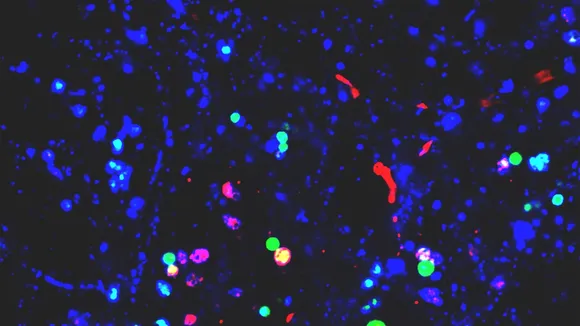 Uncovering the Potential Link Between Nanoplastics and Neurodegenerative Diseases