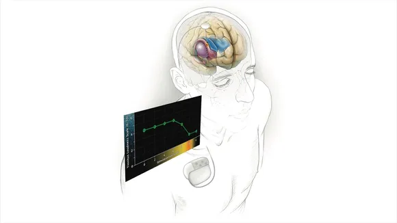 Unraveling the Mysteries of Tinnitus: New Research Insights and Treatment Possibilities