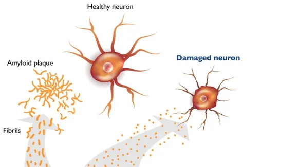 New Insights into Early Alzheimerâs: Amyloid Oligomers and Mitochondrial Energetics