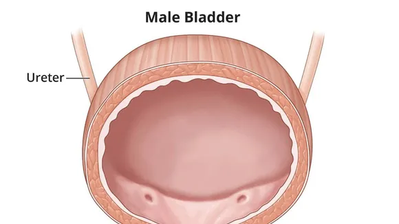 The Importance of Addressing Men's Bladder Health: Insights and Practical Advice