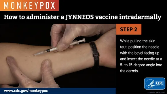 Intradermal JYNNEOS Vaccine: A Promising Approach for Monkeypox Protection in People Living with HIV