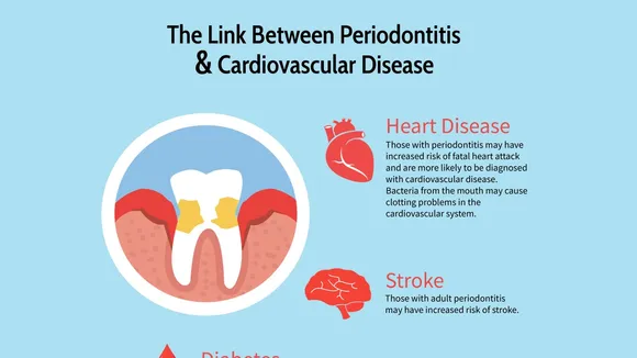 The Link Between Oral Bacteria and Cardiovascular Diseases: The Importance of Good Oral Hygiene