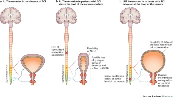 Understanding the Urinary System in Individuals with Spinal Cord Injuries: An Insight into Challenges, Treatment Options, and Future Strategies