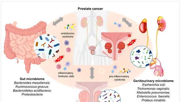 The Crucial Role of Gut Microbiota in Prostate Diseases: New Insights and Perspectives