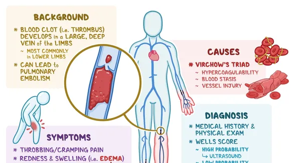 Understanding Blood Clots: Symptoms, Risks and Prevention Strategies