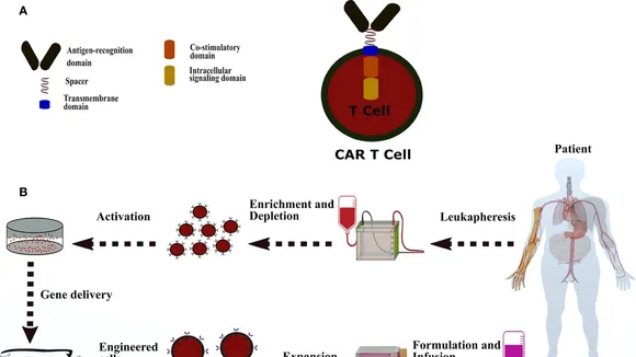 The Potential of CAR-T Therapy: A New Hope for Autoimmune Disorders