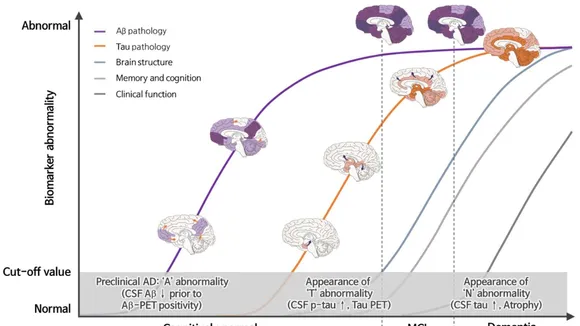 Understanding Alzheimerâs Disease: The Significance of Cerebrospinal Fluid Biomarkers