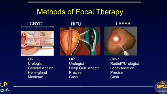 Evaluating Focal Therapy for Prostate Cancer: An Evidence-based or Oversold Approach?