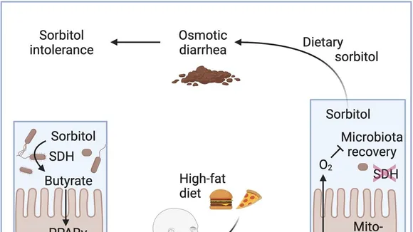 Understanding the Connection between High-Fat Diet, Antibiotics, and Sorbitol Intolerance: Insights from Recent Research