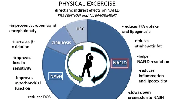 Exercise: A Potential Shield Against Alcoholic Liver Disease