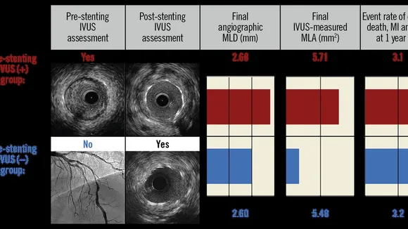 The Impact of Intravascular Imaging on Coronary Stenting: An Insight into Latest Studies