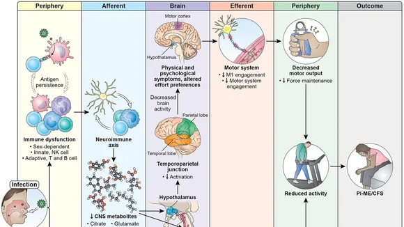 Unraveling ME/CFS: New Insights from NIH Study Highlight Differences in Brain and Immune Function