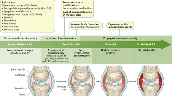 The Crucial Role of Oral Health-Related Factors in Diagnosing Osteoarthritis and Rheumatoid Arthritis
