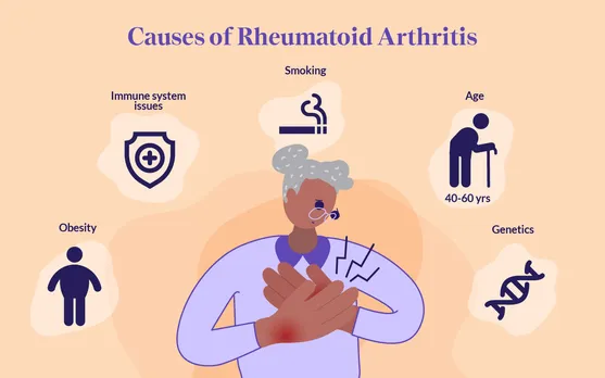 HealthMatch - Nature vs Nurture - The causes of rheumatoid arthritis and  why some people are more at risk