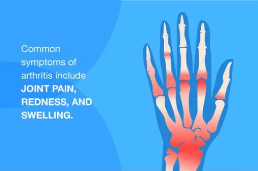 Recognizing the symptoms of arthritis