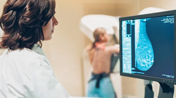 AI can help detect breast cancer. But can it improve survival rates?