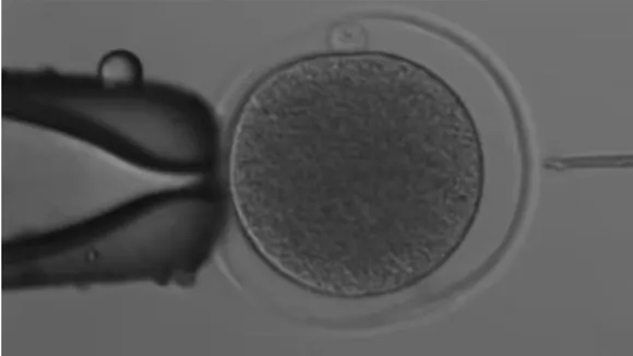 Kangaroo IVF image