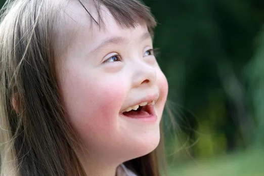 Overactive gene disrupting DNA repair found to be behind premature aging in Down's Syndrome