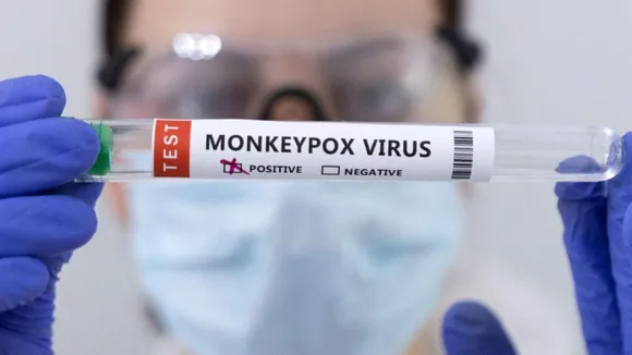 Monkeypox