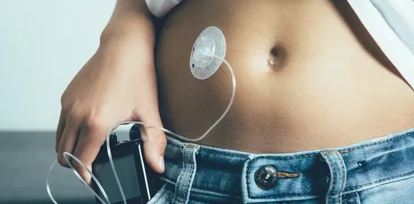 Implants like pacemakers and insulin pumps often fail because of immune attacks − stopping them could make medical devices safer and longer-lasting