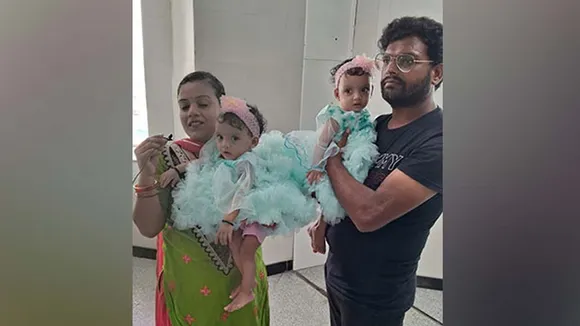Conjoined twins Riddhi and Siddhi separated successfully at AIIMS Delhi